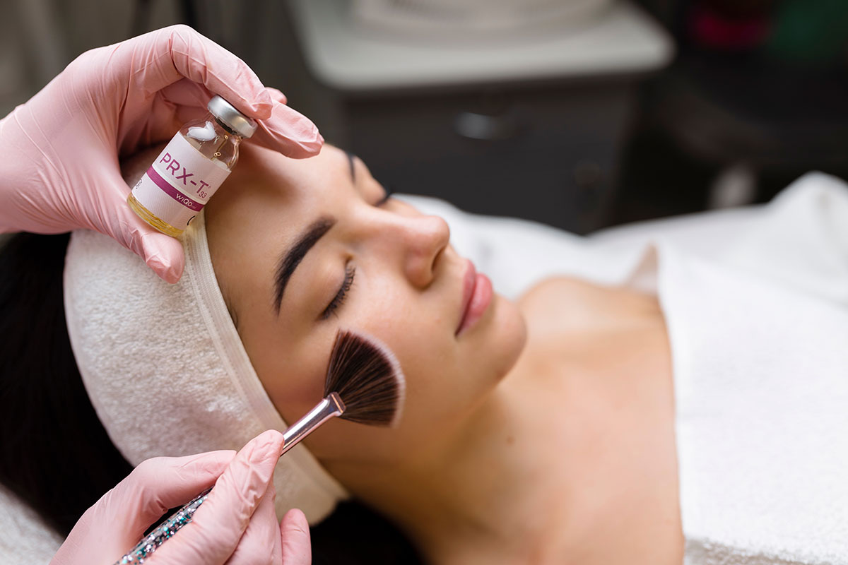 Chemical-Peel
